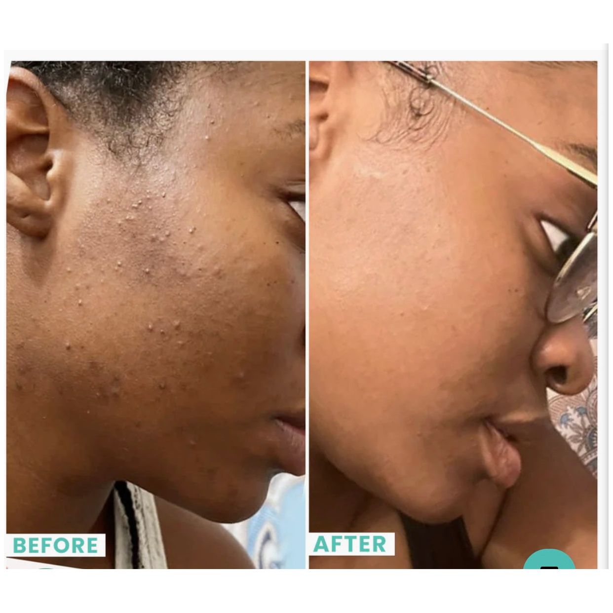 Gommage exfoliant