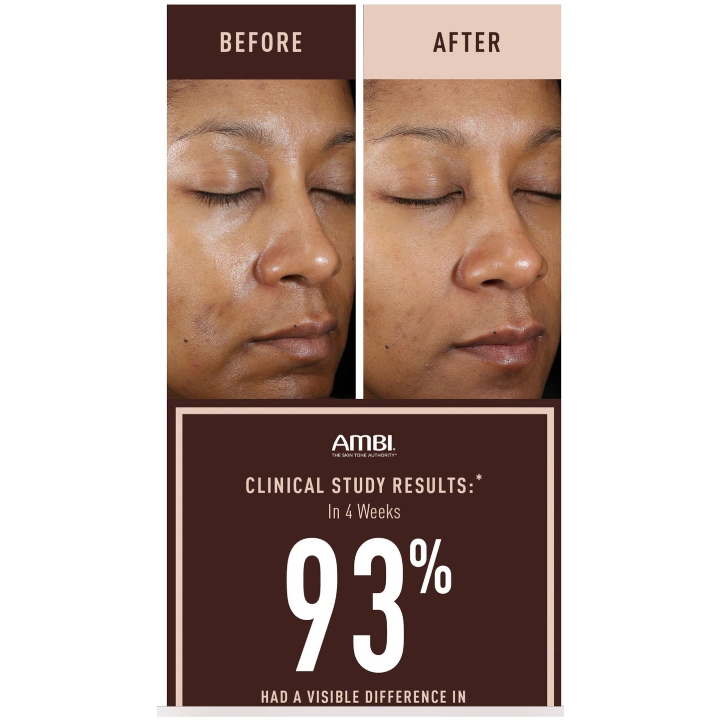 AMBI® Even & Clear Crème anti-tâches sans Hydroquinone